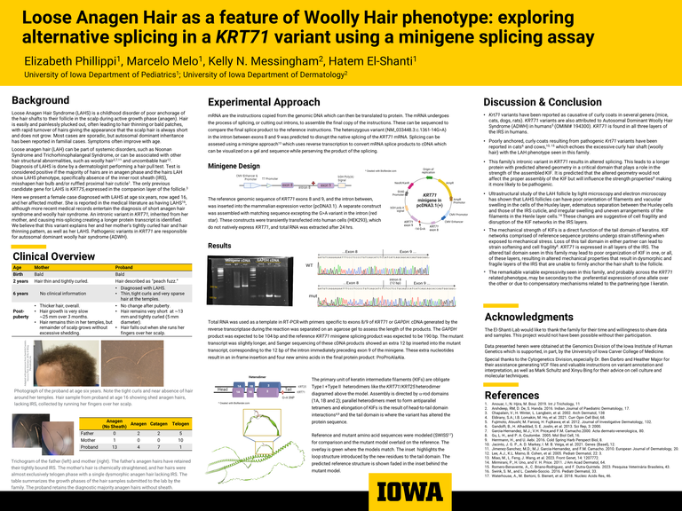 A research poster sharing the results of a functional test of a genetic variant, called a minigene experiment.