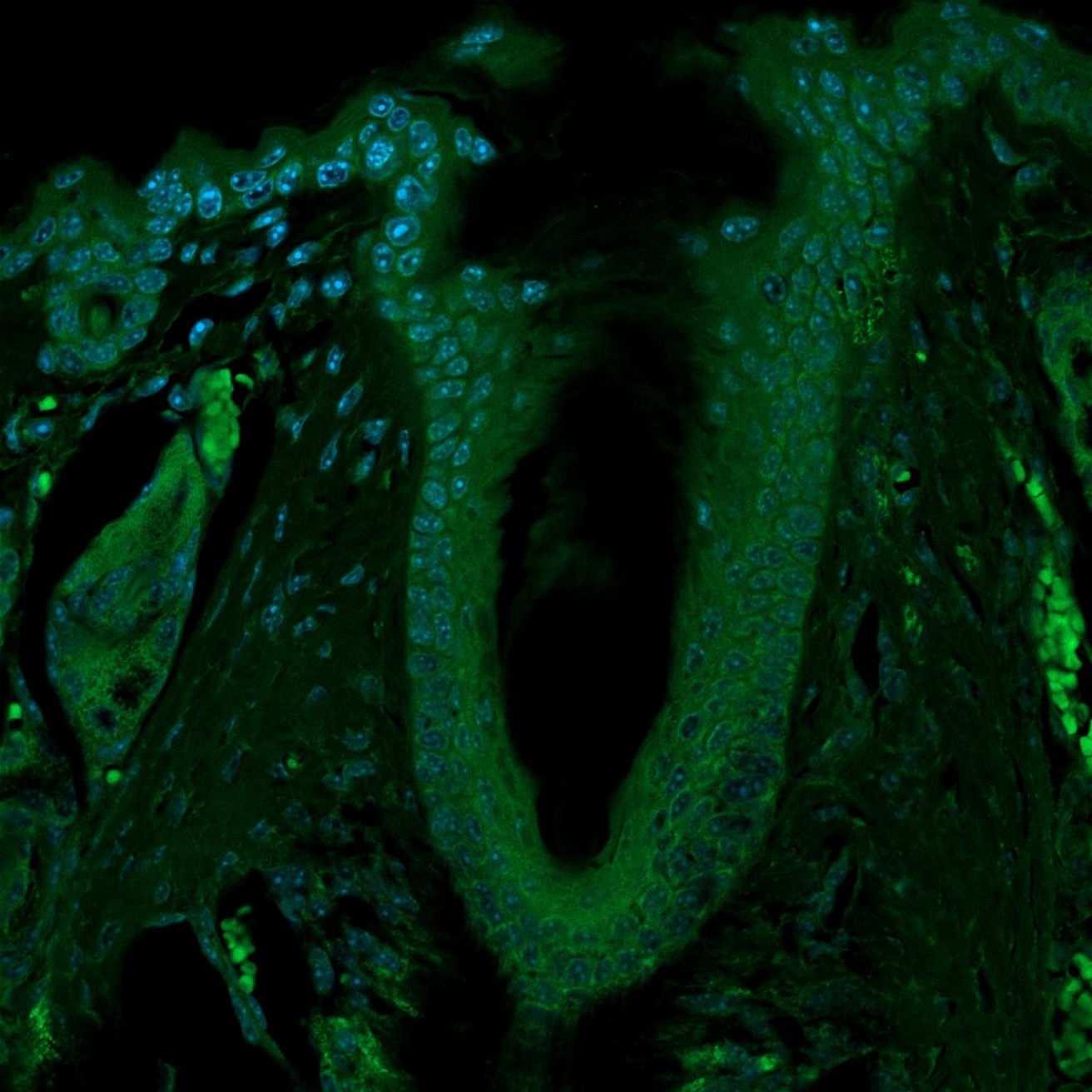 An IHC image of a hair follicle