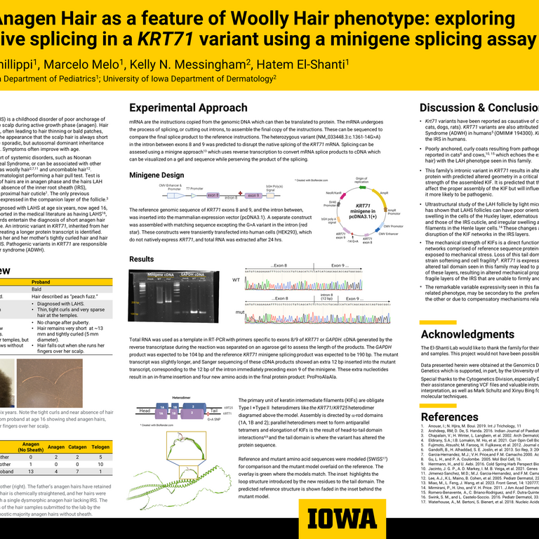 A research poster sharing the results of a functional test of a genetic variant, called a minigene experiment.