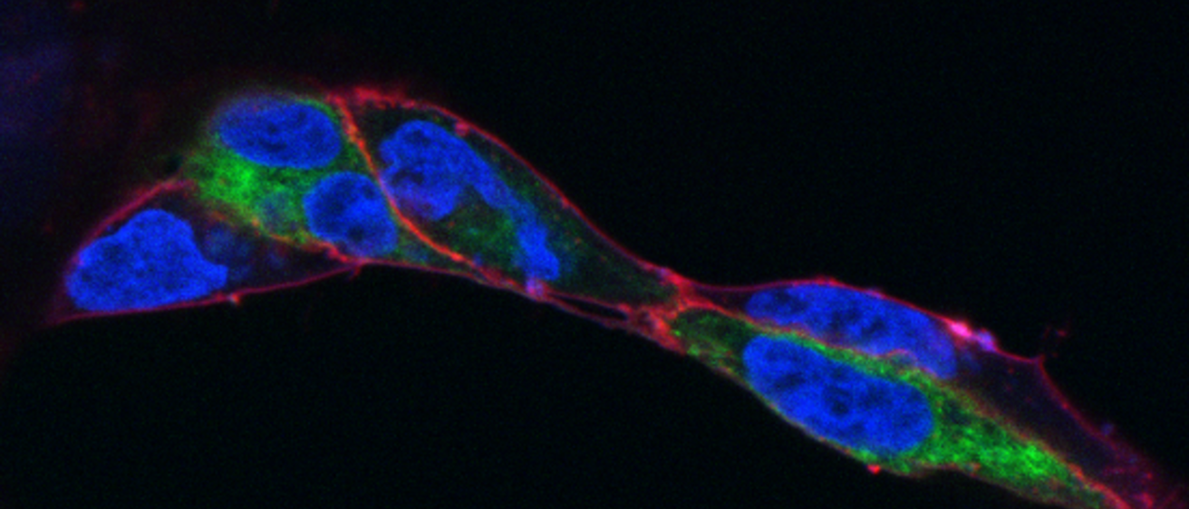Glowing cells imaged with confocal microscopy.